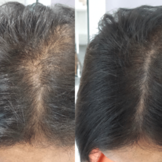 Hair Oil